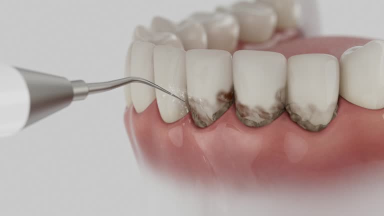 Reliable Dental contractor in Lakemore, OH by Dentist Open Now